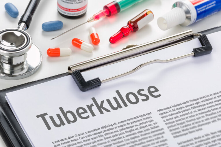 Tuberkulose